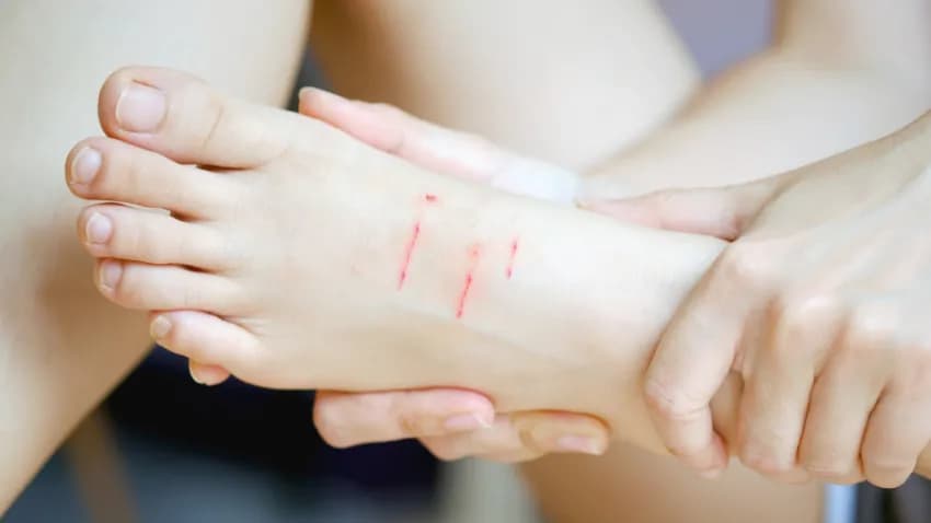 Jak skutecznie zapobiec otarciom i sprawić, by buty były komfortowe